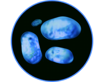 Аллергены от пылевых клещей <br>
(ковры, диваны)